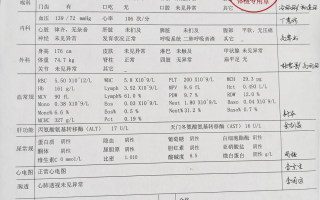 那曲找人代替抽血苏州工业园区入职体检